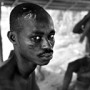 Wounds-Ghana